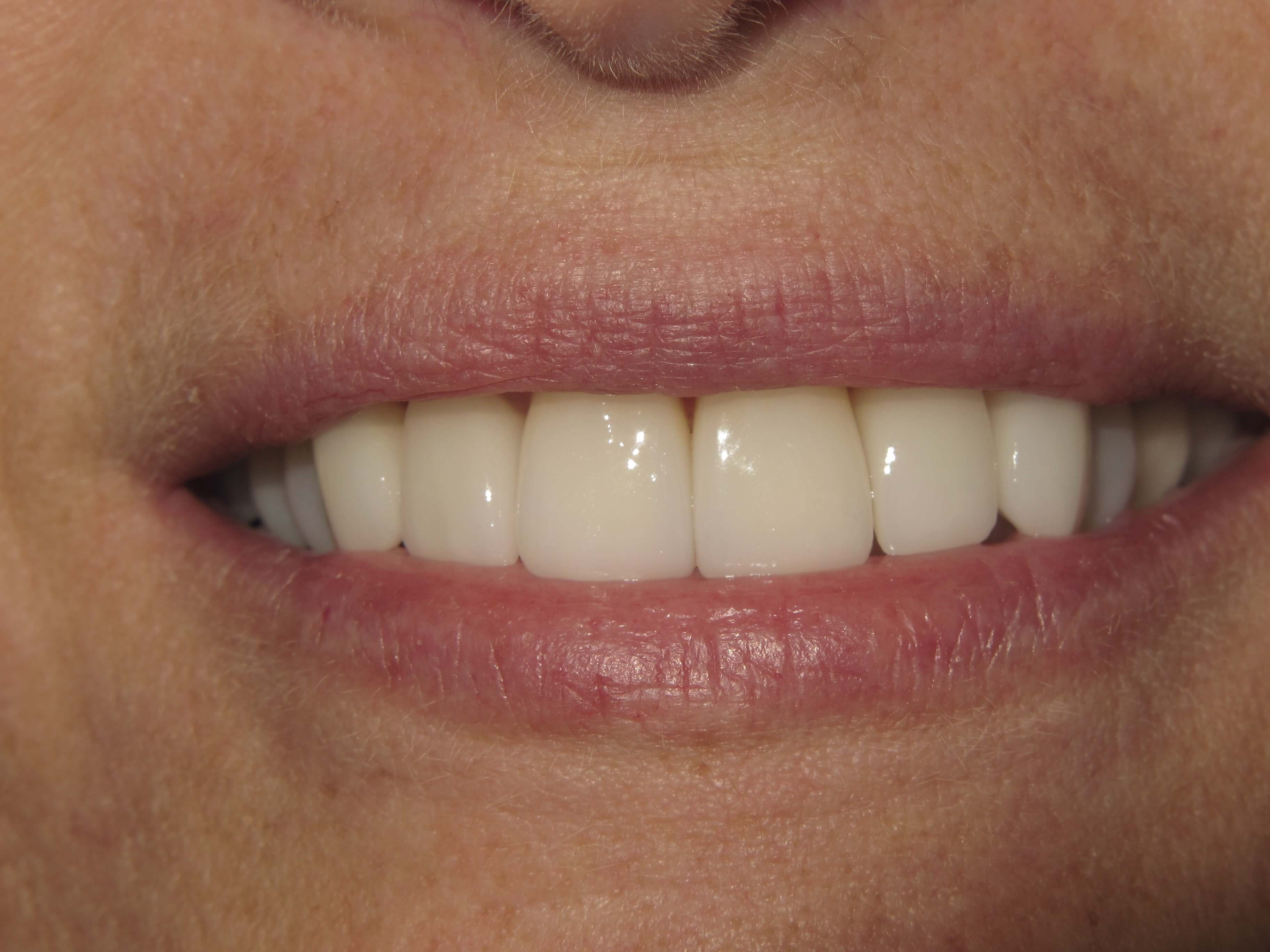 After Image