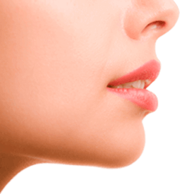 LIP LIFT Image