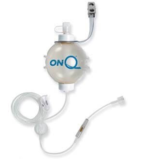 On-Q Pump